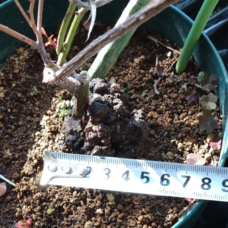 癌腫のサイズ確認